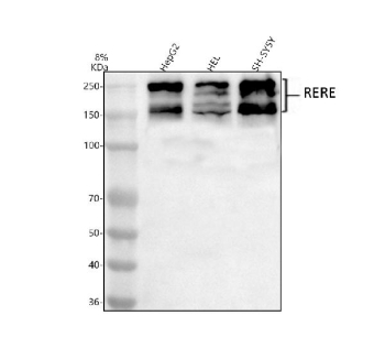 Western blot analysis of RERE using anti-RERE antibody. Lane 1: human HepG2 whole cell lysates, Lane 2: human Hela whole cell lysates, Lane 3: human SH-SY5Y whole cell lysates. After electrophoresis, proteins were transferred to a nitrocellulose membrane at 150 mA for 50-90 minutes. Blocked the membrane with 5% non-fat milk/TBS for 1.5 hour at RT. The membrane was incubated with rabbit anti-RERE antibody at 0.5 ug/ml overnight at 4oC, then washed with TBS-0.1%Tween 3 times with 5 minutes each and probed with a goat anti-rabbit IgG-HRP secondary antibody at a dilution of 1:5000 for 1.5 hour at RT. The signal was developed using enhanced chemiluminescent. Predominant bands are detected at an approximately 170 kDa, consistent with the long RERE isoform, and additional higher bands appear between ~240 and 250 kDa. In HEL lysate both the 160-170 kDa and 240-250 kDa species resolve as doublets, which likely represent differently post translationally modified forms and higher molecular weight conjugates or complexes of the long RERE isoform rather than distinct proteins.