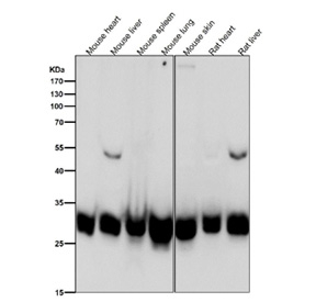 BCL2L1 Antibody Cross-Species WB. Western blot analysis of mouse heart, mouse liver, mouse spleen, mouse lung, mouse skin, rat heart, and rat liver tissue lysates using BCL2L1 Antibody demonstrates a predominant immunoreactive band at approximately 26-32 kDa, consistent with expression of Bcl-XL, the major anti-apoptotic isoform encoded by the BCL2L1 gene. Bcl-XL functions as a critical regulator of mitochondrial apoptosis by inhibiting pro-apoptotic BCL2 family proteins and promoting cellular survival across diverse tissues. A faint band near 50 kDa is observed in selected samples and may represent an SDS-resistant Bcl-XL dimer or higher-order protein complex. This higher molecular weight species is substantially less abundant than the predominant monomeric form. Antibody incubation was performed at 1:1000 dilution for 1 hour at room temperature. Predicted molecular weight: approximately 26 kDa. Commonly observed molecular weight: 26-32 kDa.