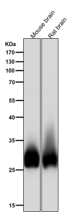 BCL2L1 Antibody Brain Tissue WB. Western blot analysis of mouse brain and rat brain tissue lysates using BCL2L1 Antibody demonstrates prominent immunoreactive bands at approximately 26-32 kDa, consistent with expression of Bcl-XL, the major anti-apoptotic isoform encoded by the BCL2L1 gene. Bcl-XL is highly expressed in neuronal tissues where it contributes to mitochondrial integrity, neuronal survival, and protection against apoptosis-induced cell death. The observed banding pattern supports conserved BCL2L1 expression across rodent brain tissues and is consistent with the established role of Bcl-XL in maintaining survival of post-mitotic neuronal populations. Antibody incubation was performed at 1:1000 dilution for 1 hour at room temperature. Predicted molecular weight: approximately 26 kDa. Commonly observed molecular weight: 26-32 kDa.