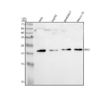 Western blot analysis of BAD using anti-BAD antibody. Lane 1: human Hela whole cell lysates, Lane 2: human HepG2 whole cell lysates, Lane 3: mouse Raw264.7 whole cell lysates, Lane 4: mouse Neuro-2a whole cell lysates. After electrophoresis, proteins were transferred to a nitrocellulose membrane at 150 mA for 50-90 minutes. Blocked the membrane with 5% non-fat milk/TBS for 1.5 hour at RT. The membrane was incubated with rabbit anti-BAD antibody at 0.5 ug/ml overnight at 4oC, then washed with TBS-0.1%Tween 3 times with 5 minutes each and probed with a goat anti-rabbit IgG-HRP secondary antibody at a dilution of 1:5000 for 1.5 hour at RT. The signal was developed using enhanced chemiluminescent. The commonly observed molecular weight of BAD is 19-23 kDa.