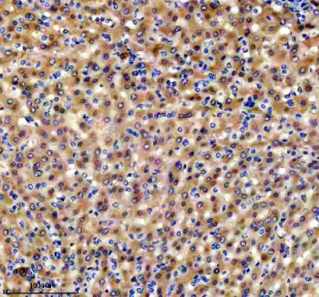 Immunohistochemical staining of UBE2W using anti-UBE2W antibody. UBE2W was detected in a paraffin-embedded section of human liver tissue. Heat mediated antigen retrieval was performed in EDTA buffer (pH 8.0, epitope retrieval solution). The tissue section was blocked with 10% goat serum. The tissue section was then incubated with 2 ug/ml rabbit anti-UBE2W antibody overnight at 4oC. Peroxidase Conjugated Goat Anti-rabbit IgG was used as secondary antibody and incubated for 30 minutes at 37oC. The tissue section was developed using an HRP secondary and DAB substrate.