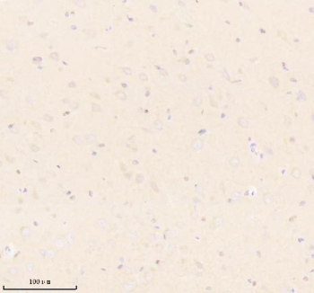 Immunohistochemical staining of UBE2W using anti-UBE2W antibody. UBE2W was detected in a paraffin-embedded section of rat brain tissue. Heat mediated antigen retrieval was performed in EDTA buffer (pH 8.0, epitope retrieval solution). The tissue section was blocked with 10% goat serum. The tissue section was then incubated with 2 ug/ml rabbit anti-UBE2W antibody overnight at 4oC. Peroxidase Conjugated Goat Anti-rabbit IgG was used as secondary antibody and incubated for 30 minutes at 37oC. The tissue section was developed using an HRP secondary and DAB substrate.