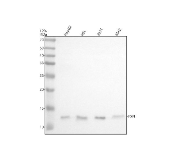 FXN Antibody Multi-Cell Line WB. Western blot analysis of human HepG2, HEL, 293T, and K562 whole cell lysates using anti-FXN antibody demonstrates consistent bands near 13-15 kDa across all tested cell lines, corresponding to the mature processed form of Frataxin / FXN following mitochondrial import-associated cleavage. The observed expression profile supports widespread cellular distribution of this mitochondrial iron metabolism protein and aligns with the established role of FXN in iron-sulfur cluster biogenesis and oxidative phosphorylation-associated energy regulation. Electrophoresis was performed on a 12% SDS-PAGE gel followed by transfer to nitrocellulose membrane and HRP-ECL detection.