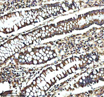 Immunohistochemical staining of GCNT2 using anti-GCNT2 antibody. GCNT2 was detected in a paraffin-embedded section of human colon tissue. Heat mediated antigen retrieval was performed in EDTA buffer (pH 8.0, epitope retrieval solution). The tissue section was blocked with 10% goat serum. The tissue section was then incubated with 2 ug/ml rabbit anti-GCNT2 antibody overnight at 4oC. Peroxidase Conjugated Goat Anti-rabbit IgG was used as secondary antibody and incubated for 30 minutes at 37oC. The tissue section was developed using an HRP secondary and DAB substrate.