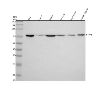 Western blot analysis of PTPRE using anti-PTPRE antibody. Electrophoresis was performed on a 10% SDS-PAGE gel at 80V (Stacking gel) / 120V (Resolving gel) for 2 hours. Lane 1: human RT4 whole cell lysates, Lane 2: human THP-1 whole cell lysates, Lane 3: human Jurkat whole cell lysates, Lane 4: rat lung tissue lysates, Lane 5: rat thymus tissue lysates, Lane 6: mouse thymus tissue lysates. After electrophoresis, proteins were transferred to a nitrocellulose membrane at 150 mA for 50-90 minutes. Blocked the membrane with 5% non-fat milk/TBS for 1.5 hour at RT. The membrane was incubated with rabbit anti-PTPRE antibody at 0.5 ug/ml overnight at 4oC, then washed with TBS-0.1%Tween 3 times with 5 minutes each and probed with a goat anti-rabbit IgG-HRP secondary antibody at a dilution of 1:5000 for 1.5 hour at RT. The signal was developed using an ECL Plus Western Blotting Substrate. A predominant band is detected in all samples at approximately 70-75 kDa, running below the predicted ~81 kDa size but consistent with the reported apparent molecular weight of endogenous PTPRE isoforms.