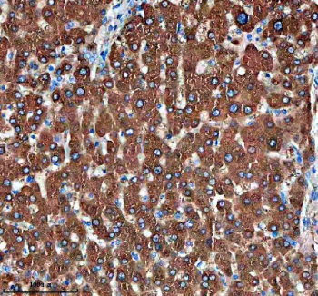 Immunohistochemical staining of PTPRE using anti-PTPRE antibody. PTPRE was detected in a paraffin-embedded section of human liver tissue. Heat mediated antigen retrieval was performed in EDTA buffer (pH 8.0, epitope retrieval solution). The tissue section was blocked with 10% goat serum. The tissue section was then incubated with 2 ug/ml rabbit anti-PTPRE antibody overnight at 4oC. Peroxidase Conjugated Goat Anti-rabbit IgG was used as secondary antibody and incubated for 30 minutes at 37oC. The tissue section was developed using an HRP secondary and DAB substrate.