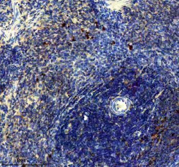 Immunohistochemical staining of PTPRE using anti-PTPRE antibody. PTPRE was detected in a paraffin-embedded section of rat spleen tissue. Heat mediated antigen retrieval was performed in EDTA buffer (pH 8.0, epitope retrieval solution). The tissue section was blocked with 10% goat serum. The tissue section was then incubated with 2 ug/ml rabbit anti-PTPRE antibody overnight at 4oC. Peroxidase Conjugated Goat Anti-rabbit IgG was used as secondary antibody and incubated for 30 minutes at 37oC. The tissue section was developed using an HRP secondary and DAB substrate.