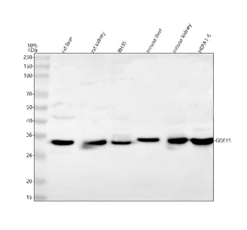 Western blot analysis of Gdf15 using anti-Gdf15 antibody. Lane 1: rat liver tissue lysates, Lane 2: rat kidney tissue lysates, Lane 3: rat RH35 whole cell lysates, Lane 4: mouse liver tissue lysates, Lane 5: mouse kidney tissue lysates, Lane 6: mouse Hepa1-6 whole cell lysates. After electrophoresis, proteins were transferred to a nitrocellulose membrane at 150 mA for 50-90 minutes. Blocked the membrane with 5% non-fat milk/TBS for 1.5 hour at RT. The membrane was incubated with rabbit anti-Gdf15 antibody at 0.25 ug/ml overnight at 4oC, then washed with TBS-0.1%Tween 3 times with 5 minutes each and probed with a goat anti-rabbit IgG-HRP secondary antibody at a dilution of 1:5000 for 1.5 hour at RT. The signal was developed using enhanced chemiluminescent. A specific band was detected for Gdf15 at approximately 34 kDa.