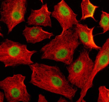 Immunofluorescent staining of EIF4A3 using anti-EIF4A3 antibody (green) and anti-Beta Tubulin antibody (red). EIF4A3 was detected in an immunocytochemical section of human A549 cells. Enzyme antigen retrieval was performed using IHC enzyme antigen retrieval reagent for 15 mins. The cells were blocked with 10% goat serum. And then incubated with 5 ug/ml rabbit anti-EIF4A3 antibody and mouse anti-Beta Tubulin antibody overnight at 4oC. DyLight 488 Conjugated Goat Anti-Rabbit IgG and Cy3 Conjugated Goat Anti-Mouse IgG were used as secondary antibody at 1:500 dilution and incubated for 30 minutes at 37oC. Visualize using a fluorescence microscope and filter sets appropriate for the label used.