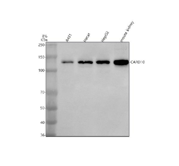 Western blot analysis of CARD10 using anti-CARD10 antibody. Lane 1: human whole cell lysates, Lane 2: human HaCaT whole cell lysates, Lane 3: human HepG2 whole cell lysates, Lane 4: mouse kidney tissue lysates. After electrophoresis, proteins were transferred to a nitrocellulose membrane at 150 mA for 50-90 minutes. Blocked the membrane with 5% non-fat milk/TBS for 1.5 hour at RT. The membrane was incubated with rabbit anti-CARD10 antibody at 0.5 ug/ml overnight at 4oC, then washed with TBS-0.1%Tween 3 times with 5 minutes each and probed with a goat anti-rabbit IgG-HRP secondary antibody at a dilution of 1:5000 for 1.5 hour at RT. The signal was developed using enhanced chemiluminescent. A strong band is detected at approximately 125-130 kDa, slightly higher than the predicted 116 kDa size, consistent with previously reported anomalous migration and phosphorylation-dependent mobility shifts of CARD10.