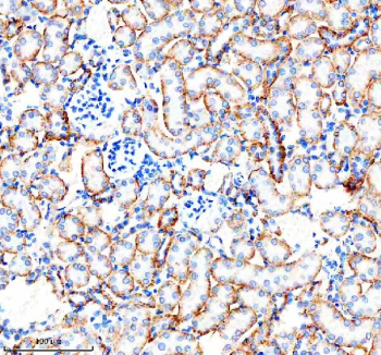 Immunohistochemical staining of CARD10 using anti-CARD10 antibody. CARD10 was detected in a paraffin-embedded section of mouse kidney tissue. Heat mediated antigen retrieval was performed in EDTA buffer (pH 8.0, epitope retrieval solution). The tissue section was blocked with 10% goat serum. The tissue section was then incubated with 2 ug/ml rabbit anti-CARD10 antibody overnight at 4oC. Peroxidase Conjugated Goat Anti-rabbit IgG was used as secondary antibody and incubated for 30 minutes at 37oC. The tissue section was developed using an HRP secondary and DAB substrate.