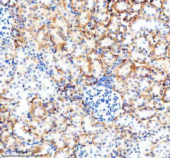Immunohistochemical staining of CARD10 using anti-CARD10 antibody. CARD10 was detected in a paraffin-embedded section of rat kidney tissue. Heat mediated antigen retrieval was performed in EDTA buffer (pH 8.0, epitope retrieval solution). The tissue section was blocked with 10% goat serum. The tissue section was then incubated with 2 ug/ml rabbit anti-CARD10 antibody overnight at 4oC. Peroxidase Conjugated Goat Anti-rabbit IgG was used as secondary antibody and incubated for 30 minutes at 37oC. The tissue section was developed using an HRP secondary and DAB substrate.