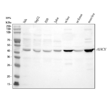 Western blot analysis of AHCY using anti-AHCY antibody. Electrophoresis was performed on a 10% SDS-PAGE gel at 80V (Stacking gel) / 120V (Resolving gel) for 2 hours. Lane 1: human Hela whole cell lysates, Lane 2: human HepG2 whole cell lysates, Lane 3: human whole cell lysates, Lane 4: human Jurkat whole cell lysates, Lane 5: rat liver tissue lysates, Lane 6: rat thymus tissue lysates, Lane 7: mouse liver tissue lysates. After electrophoresis, proteins were transferred to a nitrocellulose membrane at 150 mA for 50-90 minutes. Blocked the membrane with 5% non-fat milk/TBS for 1.5 hour at RT. The membrane was incubated with rabbit anti-AHCY antibody at 0.5 ug/ml overnight at 4oC, then washed with TBS-0.1%Tween 3 times with 5 minutes each and probed with a goat anti-rabbit IgG-HRP secondary antibody at a dilution of 1:5000 for 1.5 hour at RT. The signal was developed using an ECL Plus Western Blotting Substrate. A predominant band is detected at approximately 43 kDa in all samples, slightly below the predicted ~48 kDa size but consistent with the apparent molecular weight of endogenous S adenosylhomocysteine hydrolase under these electrophoresis conditions.