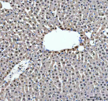 Immunohistochemical staining of AHCY using anti-AHCY antibody. AHCY was detected in a paraffin-embedded section of rat liver tissue. Heat mediated antigen retrieval was performed in EDTA buffer (pH 8.0, epitope retrieval solution). The tissue section was blocked with 10% goat serum. The tissue section was then incubated with 2 ug/ml rabbit anti-AHCY antibody overnight at 4oC. Peroxidase Conjugated Goat Anti-rabbit IgG was used as secondary antibody and incubated for 30 minutes at 37oC. The tissue section was developed using an HRP secondary and DAB substrate.