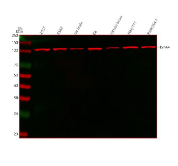 Western blot analysis of HSPA4 using anti-HSPA4 antibody. Lane 1: human 293T whole cell lysates, Lane 2: human K562 whole cell lysates, Lane 3: rat brain tissue lysates, Lane 4: rat C6 whole cell lysates, Lane 6: mouse brain tissue lysates, Lane 7: mouse NIH/3T3 whole cell lysates, Lane 8: mouse Raw264.7 whole cell lysates. After electrophoresis, proteins were transferred to a nitrocellulose membrane at 150 mA for 50-90 minutes. Blocked the membrane with 5% non-fat milk/TBS for 1.5 hour at RT. The membrane was incubated with rabbit anti-HSPA4 antibody at 0.25 ug/ml overnight at 4oC, then washed with TBS-0.1%Tween 3 times with 5 minutes each and probed with a goat anti-rabbit IgG-DyLight 647 Conjugated secondary antibody at a dilution of 1:2000 for 1.5 hour at RT. A dominant band is observed at approximately 105-110 kDa, which is the expected migration pattern for HSPA4. Although the theoretical molecular weight of HSPA4 is ~94 kDa, members of the Hsp110 family, including HSPA4, are well known to migrate 10-20 kDa heavier due to acidic domains, extended disordered regions, and phosphorylation, which reduce SDS binding and cause anomalous gel mobility.