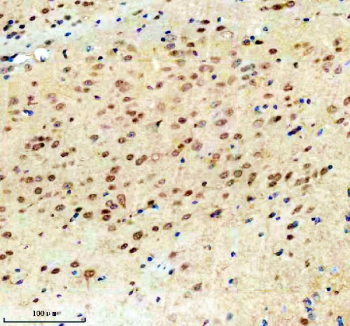 Immunohistochemical staining of TSN using anti-Translin antibody. TSN was detected in a paraffin-embedded section of mouse brain tissue. Heat mediated antigen retrieval was performed in EDTA buffer (pH 8.0, epitope retrieval solution). The tissue section was blocked with 10% goat serum. The tissue section was then incubated with 2 ug/ml rabbit anti-Translin antibody overnight at 4oC. Peroxidase Conjugated Goat Anti-rabbit IgG was used as secondary antibody and incubated for 30 minutes at 37oC. The tissue section was developed using an HRP secondary and DAB substrate.