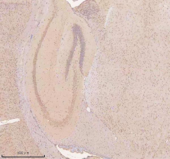 Immunohistochemical staining of TSN using anti-Translin antibody. TSN was detected in a paraffin-embedded section of mouse brain tissue. Heat mediated antigen retrieval was performed in EDTA buffer (pH 8.0, epitope retrieval solution). The tissue section was blocked with 10% goat serum. The tissue section was then incubated with 2 ug/ml rabbit anti-Translin antibody overnight at 4oC. Peroxidase Conjugated Goat Anti-rabbit IgG was used as secondary antibody and incubated for 30 minutes at 37oC. The tissue section was developed using an HRP secondary and DAB substrate.