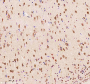 Immunohistochemical staining of TSN using anti-Translin antibody. TSN was detected in a paraffin-embedded section of rat brain tissue. Heat mediated antigen retrieval was performed in EDTA buffer (pH 8.0, epitope retrieval solution). The tissue section was blocked with 10% goat serum. The tissue section was then incubated with 2 ug/ml rabbit anti-Translin antibody overnight at 4oC. Peroxidase Conjugated Goat Anti-rabbit IgG was used as secondary antibody and incubated for 30 minutes at 37oC. The tissue section was developed using an HRP secondary and DAB substrate.