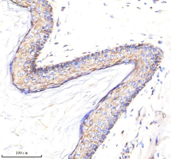 Immunohistochemical staining of MATK using anti-MATK antibody. MATK was detected in a paraffin-embedded section of human teratoma tissue. Heat mediated antigen retrieval was performed in EDTA buffer (pH 8.0, epitope retrieval solution). The tissue section was blocked with 10% goat serum. The tissue section was then incubated with 2 ug/ml rabbit anti-MATK antibody overnight at 4oC. Peroxidase Conjugated Goat Anti-rabbit IgG was used as secondary antibody and incubated for 30 minutes at 37oC. The tissue section was developed using an HRP secondary and DAB substrate.