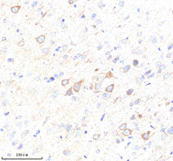 Immunohistochemical staining of MATK using anti-MATK antibody. MATK was detected in a paraffin-embedded section of rat brain tissue. Heat mediated antigen retrieval was performed in EDTA buffer (pH 8.0, epitope retrieval solution). The tissue section was blocked with 10% goat serum. The tissue section was then incubated with 2 ug/ml rabbit anti-MATK antibody overnight at 4oC. Peroxidase Conjugated Goat Anti-rabbit IgG was used as secondary antibody and incubated for 30 minutes at 37oC. The tissue section was developed using an HRP secondary and DAB substrate.