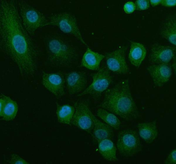 Immunofluorescent staining of MATK using anti-MATK antibody (green). MATK was detected in an immunocytochemical section of cells. Enzyme antigen retrieval was performed using IHC enzyme antigen retrieval reagent for 15 mins. The cells were blocked with 10% goat serum. And then incubated with 5 ug/ml rabbit anti-MATK antibody overnight at 4oC. DyLight 488 Conjugated Goat Anti-Rabbit IgG was used as secondary antibody at 1:500 dilution and incubated for 30 minutes at 37oC. The section was counterstained with DAPI nuclear stain (blue). Visualize using a fluorescence microscope and filter sets appropriate for the label used.