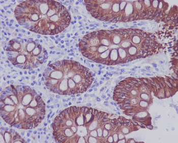KRT20 Antibody for IHC. Immunohistochemistry analysis of paraffin-embedded human colon tissue using KRT20 antibody. HRP-DAB brown chromogenic staining highlights cytoplasmic Keratin 20 / Cytokeratin 20 (KRT20) expression in colonic epithelial cells lining the glandular structures, while surrounding stromal cells remain largely negative. The staining pattern reflects the expected epithelial localization of this intermediate filament protein in gastrointestinal mucosa.
