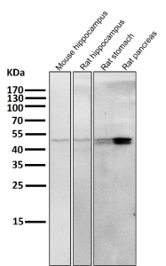 Western blot testing of mouse and rat samples using the KRT20 antibody at 1:5000 dilution for 1 hour at room temperature. The expected molecular weight of KRT20 is at 46 kDa.