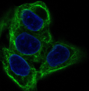 Immunofluorescent analysis of human Hela cells using KRT20 antibody (green) and DAPI nuclear stain (blue).