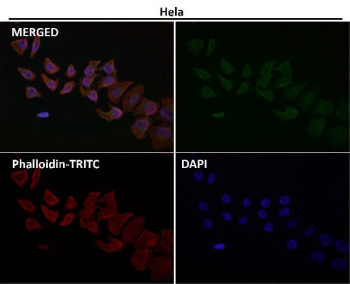 KRT20 Antibody for IF. Immunofluorescent analysis of human HeLa cells using KRT20 Antibody for IF (green) at 1:50 dilution. Cytoplasmic fluorescence highlights Keratin 20 / Cytokeratin 20 (KRT20) intermediate filament staining within epithelial cells. Phalloidin-TRITC (red) labels actin cytoskeletal filaments and DAPI (blue) marks cell nuclei. The merged image demonstrates cytoplasmic localization of KRT20 consistent with epithelial intermediate filament organization observed by fluorescence microscopy.