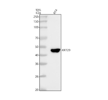 Western blot analysis of Cytokeratin 20 using anti-KRT20 antibody. Lane 1: human RT4 whole cell lysates. After electrophoresis, proteins were transferred to a nitrocellulose membrane at 150 mA for 50-90 minutes. Blocked the membrane with 5% non-fat milk/TBS for 1.5 hour at RT. The membrane was incubated with rabbit anti-KRT20 antibody at 1:1000 overnight at 4oC, then washed with TBS-0.1%Tween 3 times with 5 minutes each and probed with a goat anti-rabbit IgG-HRP secondary antibody at a dilution of 1:500 for 1.5 hour at RT. The signal was developed using enhanced chemiluminescent. The expected molecular weight of KRT20 is at 46 kDa.