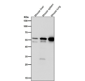 Western blot testing of mouse and rat samples using the LYN antibody at 1:1000 dilution for 1 hour at room temperature. Predicted molecular weight ~53 kDa (p53lyn), ~56 kDa (p56lyn).