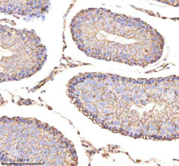 Immunohistochemical staining of ENO1 using anti-ENO1 antibody. ENO1 was detected in a paraffin-embedded section of rat testis tissue. Heat mediated antigen retrieval was performed in EDTA buffer (pH 8.0, epitope retrieval solution). The tissue section was blocked with 10% goat serum. The tissue section was then incubated with 2 ug/ml rabbit anti-ENO1 antibody overnight at 4oC. Peroxidase Conjugated Goat Anti-rabbit IgG was used as secondary antibody and incubated for 30 minutes at 37oC. The tissue section was developed using an HRP secondary and DAB substrate.