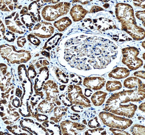 BCKDH E2 Antibody staining of human kidney by IHC. Immunohistochemistry of FFPE human kidney sections using the BCKDH E2 Antibody at 2 ug/ml. Strong granular brown cytoplasmic staining is prominent within renal tubular epithelial cells, while glomerular structures show comparatively little staining. Nuclei are counterstained blue and remain largely negative. Heat-mediated antigen retrieval was performed in pH 8 EDTA before antibody incubation. The predominantly cytoplasmic pattern is consistent with the mitochondrial localization of DBT and demonstrates tissue detection of dihydrolipoamide branched-chain transacylase E2 with this DBT Antibody.