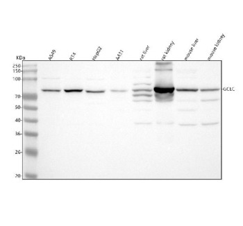 GCLC Antibody Multi-Species WB. Western blot analysis using GCLC Antibody / Glutathione Biosynthesis Antibody demonstrates strong immunoreactive bands at approximately 73 kDa in human HeLa, Jurkat, and HepG2 cell lysates, as well as rat brain, rat C6, and mouse brain samples. The observed molecular weight is consistent with the predicted size of Glutamate-Cysteine Ligase Catalytic Subunit (GCLC), the catalytic component of the rate-limiting enzyme in glutathione biosynthesis. Consistent detection across human, rat, and mouse samples supports recognition of a conserved GCLC epitope and demonstrates broad species reactivity. Additional lower molecular weight bands observed in selected samples are consistent with previously reported truncated or proteolytically processed forms of GCLC. The observed immunoreactivity demonstrates the utility of this antibody for studies of glutathione metabolism, oxidative stress responses, antioxidant defense pathways, cellular detoxification, and redox regulation.