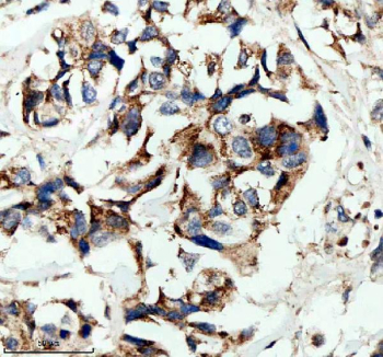 Immunofluorescent staining of HPGD using anti-HPGD antibody (green) and anti-Beta Tubulin antibody (red). HPGD was detected in an immunocytochemical section of cells. Enzyme antigen retrieval was performed using IHC enzyme antigen retrieval reagent for 15 mins. The cells were blocked with 10% goat serum. And then incubated with 5 ug/ml rabbit anti-HPGD antibody and mouse anti-Beta Tubulin antibody overnight at 4oC. DyLight 488 Conjugated Goat Anti-Rabbit IgG and Cy3 Conjugated Goat Anti-Mouse IgG were used as secondary antibody at 1:500 dilution and incubated for 30 minutes at 37oC. Visualize using a fluorescence microscope and filter sets appropriate for the label used.