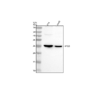 Western blot analysis of HPGD using anti-HPGD antibody. Electrophoresis was performed on a 12% SDS-PAGE gel at 80V (Stacking gel) / 120V (Resolving gel) for 2 hours. Lane 1: human RT4 whole cell lysates, Lane 2: human whole cell lysates. After electrophoresis, proteins were transferred to a nitrocellulose membrane at 150 mA for 50-90 minutes. Blocked the membrane with 5% non-fat milk/TBS for 1.5 hour at RT. The membrane was incubated with rabbit anti-HPGD antibody at 0.5 ug/ml overnight at 4oC, then washed with TBS-0.1%Tween 3 times with 5 minutes each and probed with a goat anti-rabbit IgG-HRP secondary antibody at a dilution of 1:5000 for 1.5 hour at RT. The signal was developed using an ECL Plus Western Blotting Substrate. A strong band was detected at approximately 26 kDa, which is slightly lower than the predicted 29 kDa but consistent with the known migration behavior of HPGD reported in the literature.