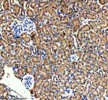 Immunohistochemical staining of HPGD using anti-HPGD antibody. HPGD was detected in a paraffin-embedded section of mouse kidney tissue. Heat mediated antigen retrieval was performed in EDTA buffer (pH 8.0, epitope retrieval solution). The tissue section was blocked with 10% goat serum. The tissue section was then incubated with 2 ug/ml rabbit anti-HPGD antibody overnight at 4oC. Peroxidase Conjugated Goat Anti-rabbit IgG was used as secondary antibody and incubated for 30 minutes at 37oC. The tissue section was developed using an HRP secondary and DAB substrate.