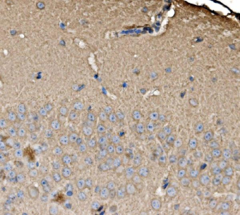 Immunohistochemical staining of FFPE mouse brain tissue with SRP72 antibody, HRP-secondary and DAB substrate. HIER: boil tissue sections in pH8 EDTA for 20 min and allow to cool before testing.