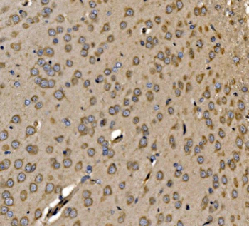 Immunohistochemical staining of FFPE rat brain tissue with SRP72 antibody, HRP-secondary and DAB substrate. HIER: boil tissue sections in pH8 EDTA for 20 min and allow to cool before testing.
