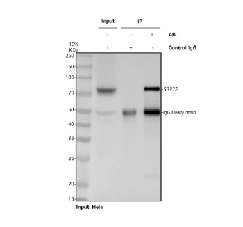 Immunoprecipitation of SRP72 protein from 500ug of human HeLa whole cell lysate with 2ug of SRP72 antibody.