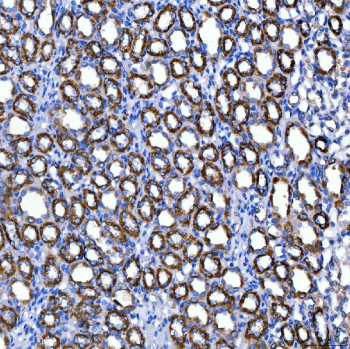 Immunohistochemical staining of FFPE rat kidney tissue with SUCLG2 antibody, HRP-secondary and DAB substrate. HIER: boil tissue sections in pH8 EDTA for 20 min and allow to cool before testing.