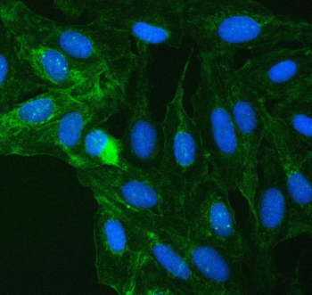 Immunofluorescent staining of FFPE human U-2 OS cells with SUCLG2 antibody (green) and DAPI nuclear stain (blue). HIER: steam section in pH6 citrate buffer for 20 min.