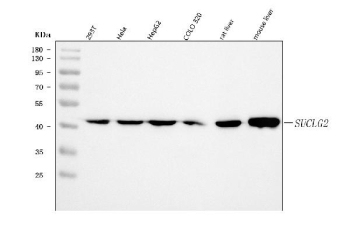 Western blot testing of 1) human 293T, 2) human HeLa, 3) human HepG2, 4) human COLO320, 5) rat liver and 6) mouse liver tissue lysate with SUCLG2 antibody. Predicted molecular weight ~47 kDa.