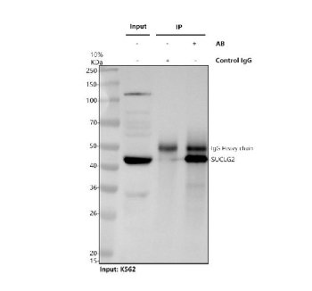 Immunoprecipitation of SUCLG2 protein from 500ug of human K562 whole cell lysate with 2ug of SUCLG2 antibody.