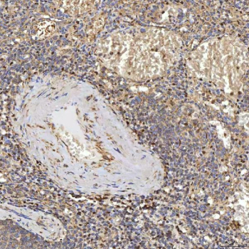 Immunohistochemical staining of FFPE human spleen tissue with SUCLG2 antibody, HRP-secondary and DAB substrate. HIER: boil tissue sections in pH8 EDTA for 20 min and allow to cool before testing.