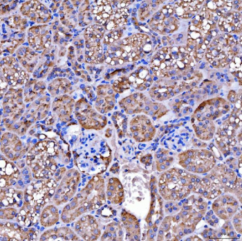 Immunohistochemical staining of FFPE mouse kidney tissue with SUCLG2 antibody, HRP-secondary and DAB substrate. HIER: boil tissue sections in pH8 EDTA for 20 min and allow to cool before testing.