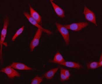 Immunofluorescent staining of FFPE human PC-3 cells with Synoviolin antibody (red) and DAPI nuclear stain (blue). HIER: steam section in pH6 citrate buffer for 20 min.