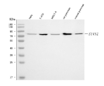 Western blot testing of 1) human HeLa, 2) human T-47D, 3) human MOLT4, 4) rat pancreas and 5) mouse pancreas tissue lysate with Synoviolin antibody. The predicted mass is ~68 kDa, but SYVN1 can migrate higher on SDS-PAGE due to membrane-protein behavior and post-translational modification and isoform heterogeneity.