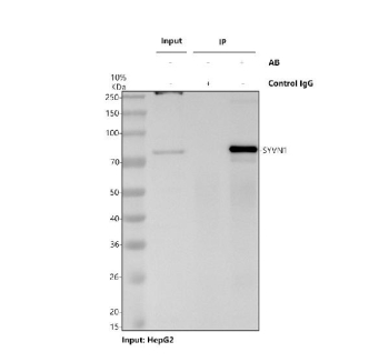 Immunoprecipitation of Synoviolin protein from 500ug of human HepG2 whole cell lysate with 2ug of Synoviolin antibody.