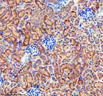 Immunohistochemical staining of FFPE mouse kidney tissue with Sonic Hedgehog antibody, HRP-secondary and DAB substrate. HIER: boil tissue sections in pH8 EDTA for 20 min and allow to cool before testing.